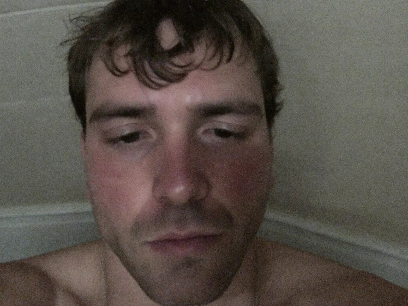 Before — flat
