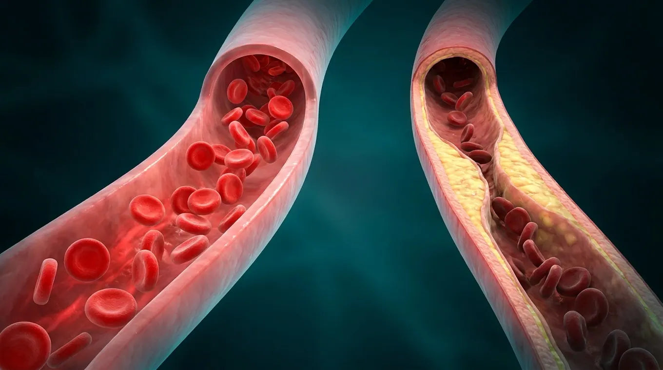 Young flexible artery versus aged narrowed artery 3D comparison